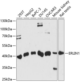 Western blot - ERLIN1 Polyclonal Antibody 