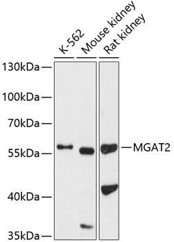 Western blot - MGAT2 Polyclonal Antibody 