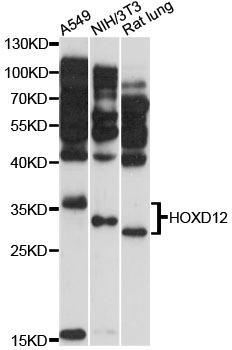 Western blot - HOXD12 Polyclonal Antibody 