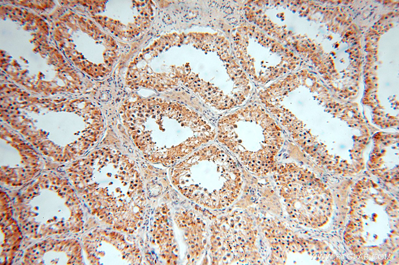 Immunohistochemical of paraffin-embedded human testis using Catalog No:111226(GTDC1 antibody) at dilution of 1:100 (under 10x lens)