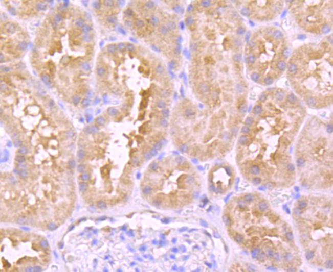 Fig4:; Immunohistochemical analysis of paraffin-embedded human kidney tissue using anti-Urokinase antibody. The section was pre-treated using heat mediated antigen retrieval with Tris-EDTA buffer (pH 8.0-8.4) for 20 minutes.The tissues were blocked in 5% BSA for 30 minutes at room temperature, washed with ddH; 2; O and PBS, and then probed with the primary antibody ( 1/50) for 30 minutes at room temperature. The detection was performed using an HRP conjugated compact polymer system. DAB was used as the chromogen. Tissues were counterstained with hematoxylin and mounted with DPX.