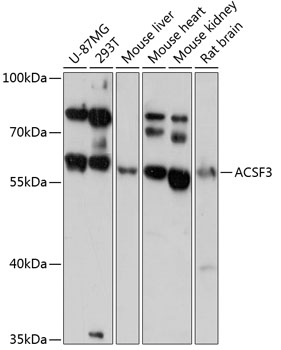 Western blot - ACSF3 Polyclonal Antibody 