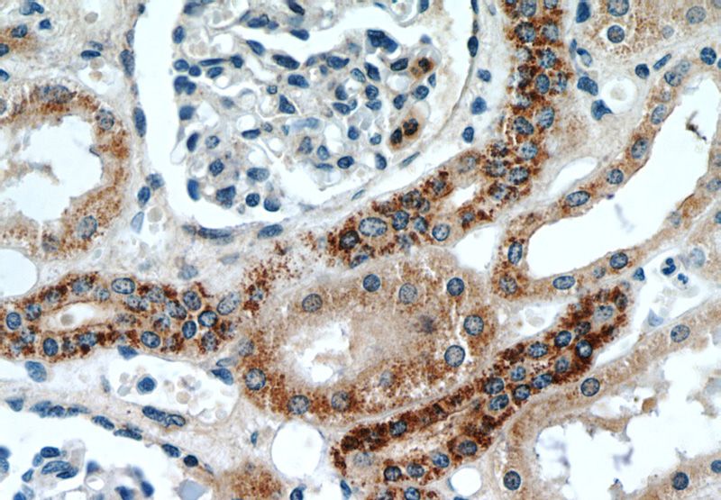Immunohistochemistry of paraffin-embedded human kidney slide using Catalog No:116134(TIMM50 Antibody) at dilution of 1:50