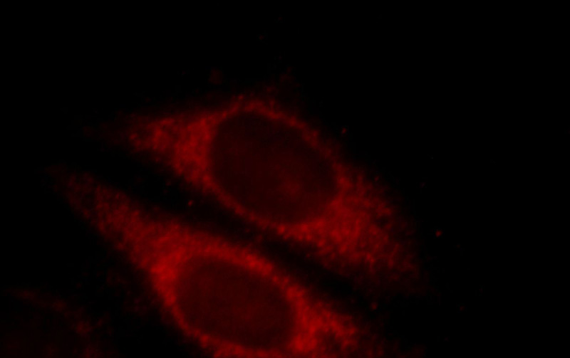 Immunofluorescent analysis of HepG2 cells, using CLINT1antibody Catalog No:109391 at 1:25 dilution and Rhodamine-labeled goat anti-rabbit IgG (red).