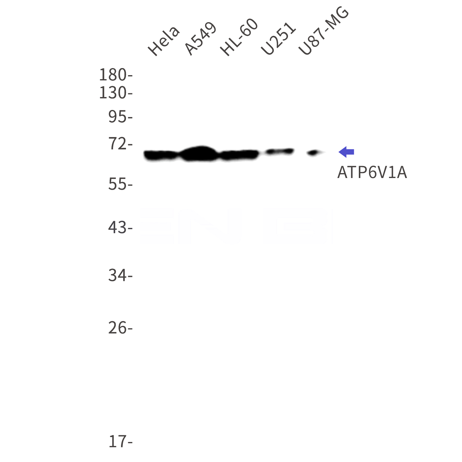 Western blot detection of ATP6V1A in Hela,A549,HL-60,U251,U87-MG cell lysates using ATP6V1A Rabbit mAb(1:1000 diluted).Predicted band size:68kDa.Observed band size:68kDa.