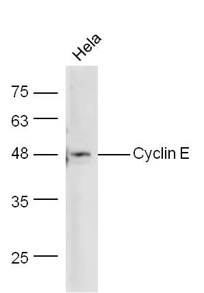 Fig4: Sample: Hela Lysate at 40 ug; Primary: Anti-Cyclin E at 1/300 dilution; Secondary: IRDye800CW Goat Anti-Rabbit IgG at 1/10000 dilution; Predicted band size: 45 kD; Observed band size: 48 kD