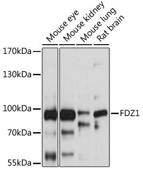 Western blot - FZD1 Polyclonal Antibody 