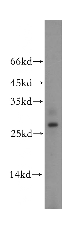 human kidney tissue were subjected to SDS PAGE followed by western blot with Catalog No:108569(BPHL antibody) at dilution of 1:500