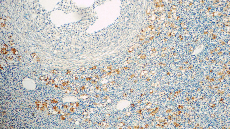 Immunohistochemistry of paraffin-embedded human ovary tissue slide using Catalog No:116075(TLR5 Antibody) at dilution of 1:50 (under 10x lens)