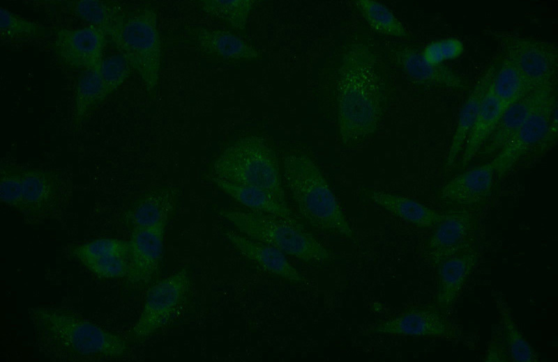 Immunofluorescent analysis of A375 cells using Catalog No:114952(S100B Antibody) at dilution of 1:25 and Alexa Fluor 488-congugated AffiniPure Goat Anti-Rabbit IgG(H+L)