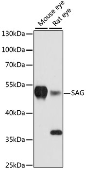 Western blot - SAG Polyclonal Antibody 