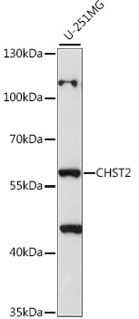 Western blot - CHST2 Polyclonal Antibody 