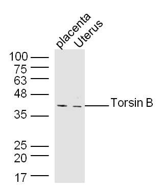 Fig1: Sample:; Placenta (Mouse) Lysate at 40 ug; Uterus (Mouse) Lysate at 40 ug; Primary: Anti-Torsin B at 1/300 dilution; Secondary: IRDye800CW Goat Anti-Rabbit IgG at 1/20000 dilution; Predicted band size: 36 kD; Observed band size: 40 kD