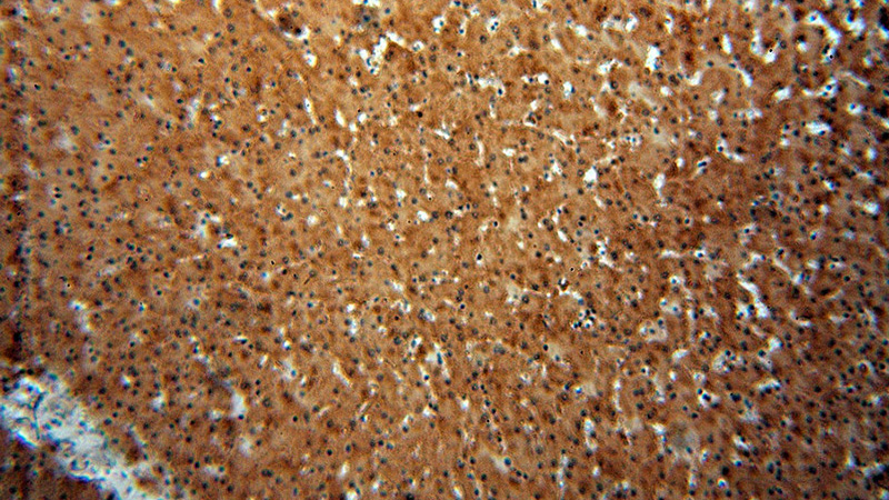 Immunohistochemical of paraffin-embedded human liver using Catalog No:115171(SGMS1 antibody) at dilution of 1:50 (under 10x lens)