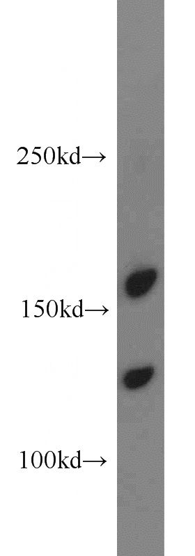 mouse brain tissue were subjected to SDS PAGE followed by western blot with Catalog No:108103(ANO8 antibody) at dilution of 1:500