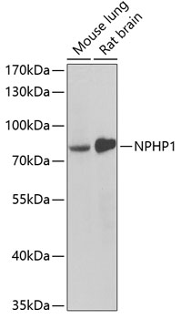 Western blot - NPHP1 Polyclonal Antibody 