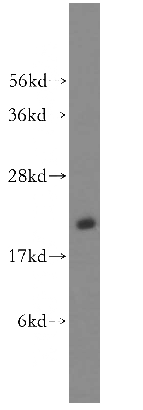 human brain tissue were subjected to SDS PAGE followed by western blot with Catalog No:114434(RAB35 antibody) at dilution of 1:600