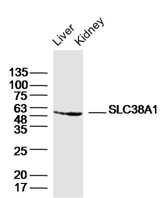 Fig1: Sample:; Liver (Mouse) Lysate at 40 ug; Kidney (Mouse) Lysate at 40 ug; Primary: Anti- SLC38A1 at 1/300 dilution; Secondary: IRDye800CW Goat Anti-Rabbit IgG at 1/20000 dilution; Predicted band size: 54kD; Observed band size: 54kD