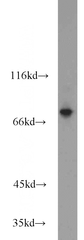 mouse skeletal muscle tissue were subjected to SDS PAGE followed by western blot with Catalog No:109980(DIXDC1 antibody) at dilution of 1:1500