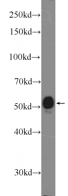 mouse heart tissue were subjected to SDS PAGE followed by western blot with Catalog No:110553(FBXO32 Antibody) at dilution of 1:600