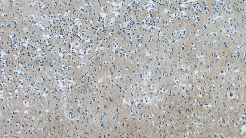 Immunohistochemistry of paraffin-embedded human brain tissue slide using Catalog No:113124(NCDN Antibody) at dilution of 1:50 (under 10x lens)