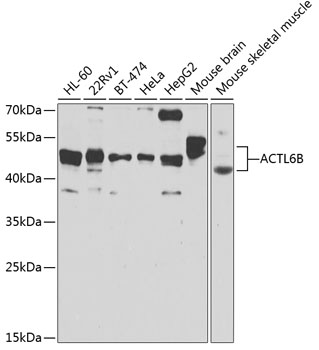 Western blot - ACTL6B Polyclonal Antibody 