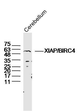 Fig5: Sample: Cerebellum (Mouse) Lysate at 40 ug; Primary: Anti-XIAP/BIRC4 at 1/300 dilution; Secondary: IRDye800CW Goat Anti-Rabbit IgG at 1/20000 dilution; Predicted band size: 55 kD; Observed band size: 55 kD