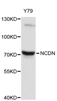 Western blot - NCDN Polyclonal Antibody 