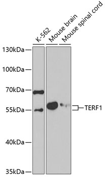 Western blot - TERF1 Polyclonal Antibody 