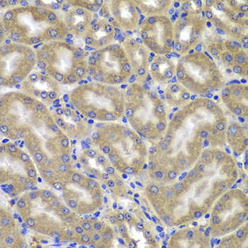 Immunohistochemistry - NLRC4 Polyclonal Antibody 