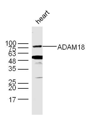 Fig1: Sample:; Heart (Mouse) Lysate at 40 ug; Primary: Anti- ADAM18 (bs-10196R) at 1/300 dilution; Secondary: IRDye800CW Goat Anti-Rabbit IgG at 1/20000 dilution; Predicted band size: 62 kD; Observed band size: 75/50 kD