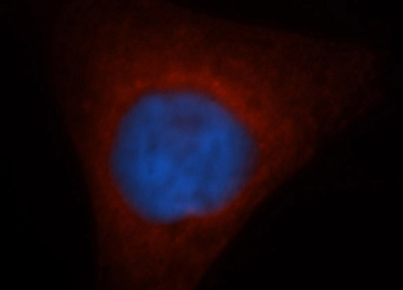 Immunofluorescent analysis of HepG2 cells, using GSTM5 antibody Catalog No:111188 at 1:50 dilution and Rhodamine-labeled goat anti-rabbit IgG (red). Blue pseudocolor = DAPI (fluorescent DNA dye).