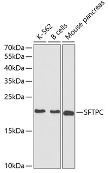 Western blot - SFTPC Polyclonal Antibody 