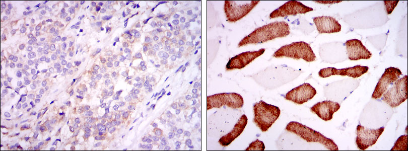 Immunohistochemical analysis of paraffin-embedded bladder cancer tissues (left) and skeletal muscle tissues (right) using ABCG2 mouse mAb with DAB staining.
