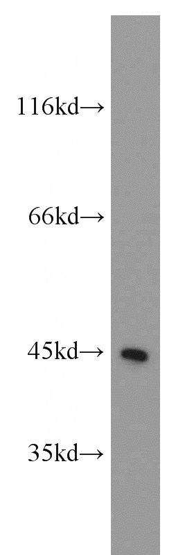 Jurkat cells were subjected to SDS PAGE followed by western blot with Catalog No:112502(MBD2 antibody) at dilution of 1:1000