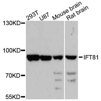 Western blot - IFT81 Polyclonal Antibody 