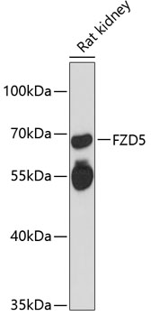 Western blot - FZD5 Polyclonal Antibody 