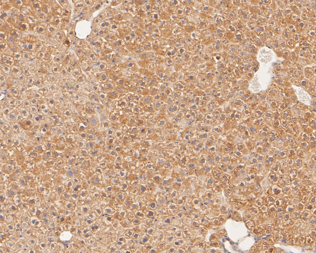 Fig4:; Immunohistochemical analysis of paraffin-embedded mouse liver tissue using anti-GM648 antibody. The section was pre-treated using heat mediated antigen retrieval with Tris-EDTA buffer (pH 8.0-8.4) for 20 minutes.The tissues were blocked in 5% BSA for 30 minutes at room temperature, washed with ddH; 2; O and PBS, and then probed with the primary antibody ( 1/100) for 30 minutes at room temperature. The detection was performed using an HRP conjugated compact polymer system. DAB was used as the chromogen. Tissues were counterstained with hematoxylin and mounted with DPX.