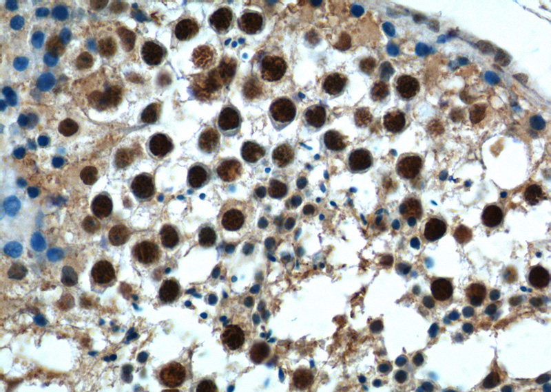 Immunohistochemistry of paraffin-embedded human testis tissue slide using Catalog No:113280(NRIP3 Antibody) at dilution of 1:50 (under 40x lens)