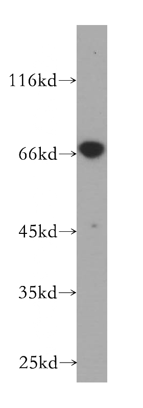 HeLa cells were subjected to SDS PAGE followed by western blot with Catalog No:109728(CTPS antibody) at dilution of 1:500