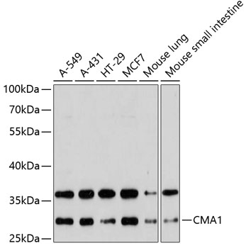 Western blot - CMA1 Polyclonal Antibody 
