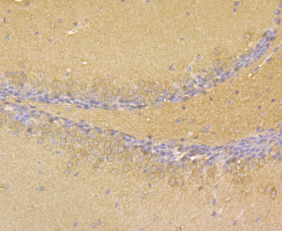 Fig6: Immunohistochemical analysis of paraffin-embedded mouse brain tissue using anti-RYR3 antibody. The section was pre-treated using heat mediated antigen retrieval with Tris-EDTA buffer (pH 8.0-8.4) for 20 minutes.The tissues were blocked in 5% BSA for 30 minutes at room temperature, washed with ddH2O and PBS, and then probed with the antibody at 1/50 dilution, for 30 minutes at room temperature and detected using an HRP conjugated compact polymer system. DAB was used as the chrogen. Counter stained with hematoxylin and mounted with DPX.