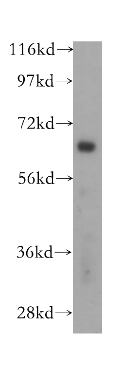 mouse brain tissue were subjected to SDS PAGE followed by western blot with Catalog No:114548(RAP1GDS1 antibody) at dilution of 1:500