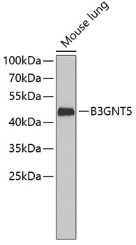 Western blot - B3GNT5 Polyclonal Antibody 