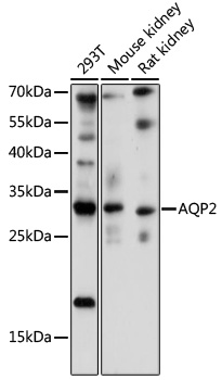 Western blot - AQP2 Polyclonal Antibody 