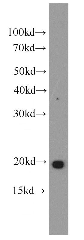 human brain tissue were subjected to SDS PAGE followed by western blot with Catalog No:113793(PGPEP1 antibody) at dilution of 1:600