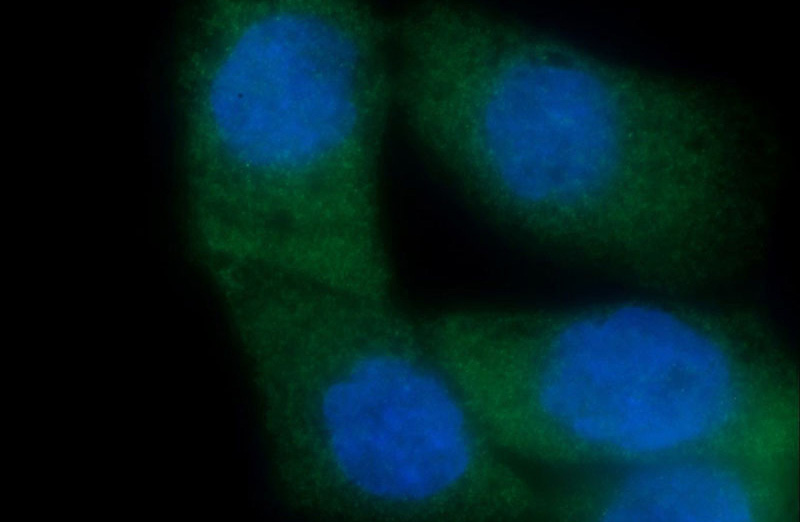 Immunofluorescent analysis of COLO 320 cells using Catalog No:109539(CRBN Antibody) at dilution of 1:50 and Alexa Fluor 488-congugated AffiniPure Goat Anti-Rabbit IgG(H+L)