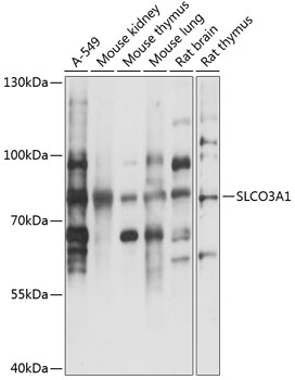 Western blot - SLCO3A1 Polyclonal Antibody 