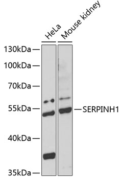 Western blot - SERPINH1 Polyclonal Antibody 
