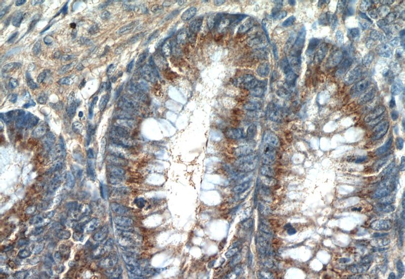 Immunohistochemistry of paraffin-embedded human colon tissue slide using Catalog No:115030(SDF4 Antibody) at dilution of 1:50 (under 40x lens)